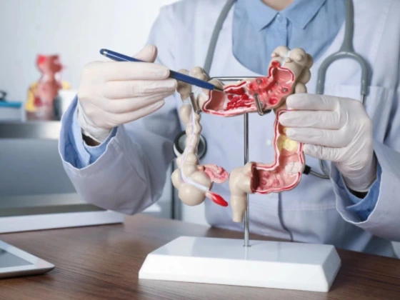 Polypectomy